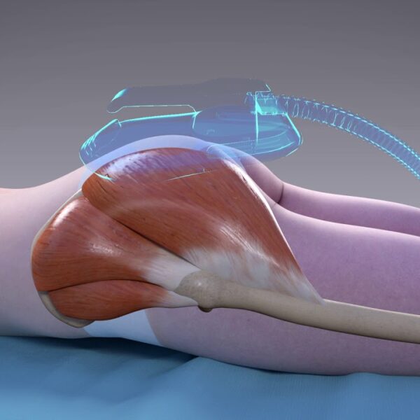 Slim Beauty Technician Course Online BC Medical Spa
